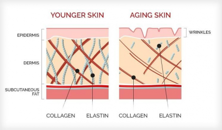 Thiếu hụt collagen chính là nguyên nhân làm cho làn da kém đàn hồi, chảy xệ, chùng nhão