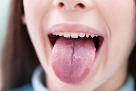 Lưỡi bản đồ collagen Nhật Bản là một phương pháp mới giúp đẩy nhanh quá trình phục hồi và cải thiện tình trạng lưỡi bị viêm. Sản phẩm không gây đau đớn và rất an toàn cho sức khỏe. Chỉ cần sử dụng đều đặn, bạn sẽ cảm nhận được sự khác biệt cho lưỡi của mình.