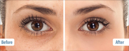 Kem chống nhăn, thâm vùng da mắt Obagi ELASTIderm Eye Treatment Cream15g được ưa chuộng hàng đầu tại Mỹ-Cửa Hàng Làm Đẹp